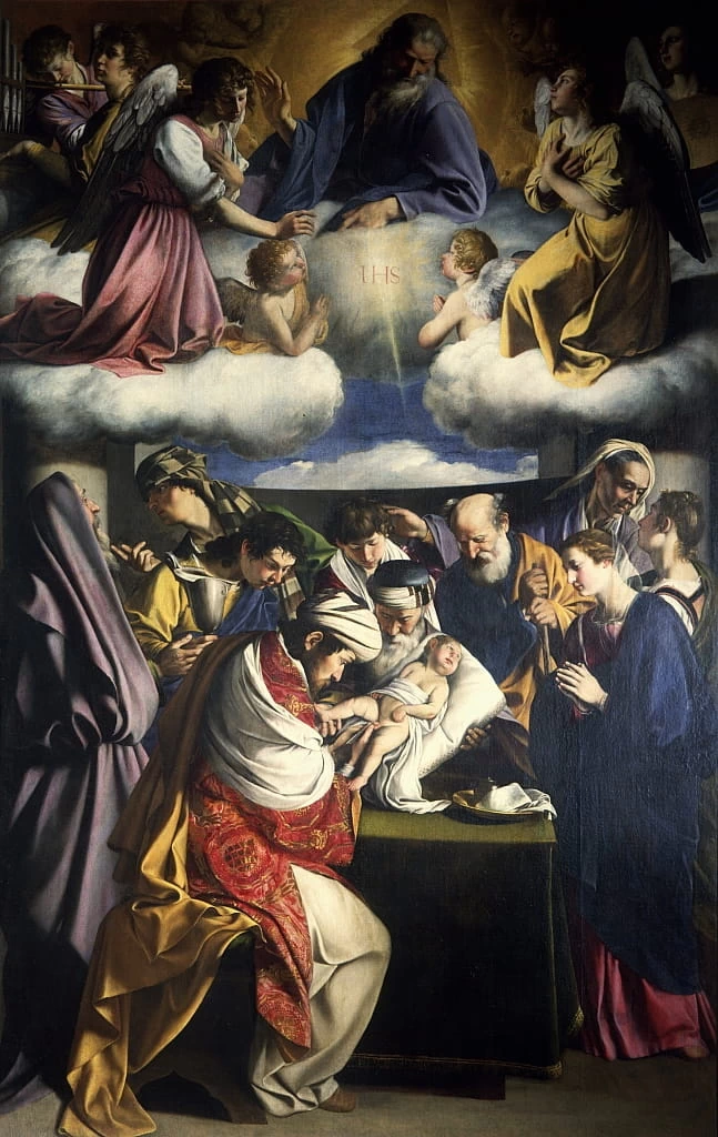 Circoncisione di Gesù